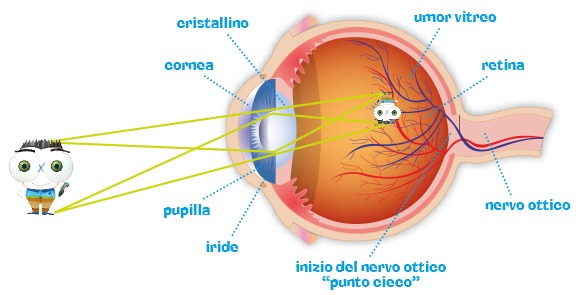 miopia retina sottile viziunea 0 3 este rea